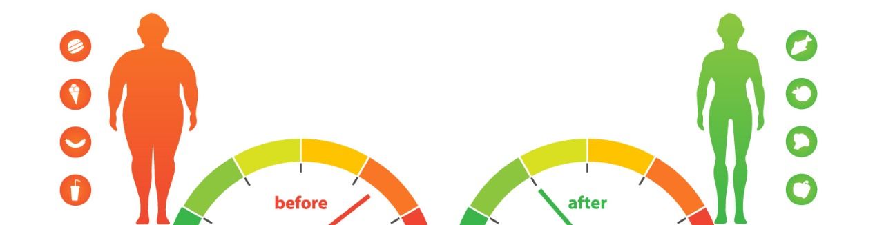 BMI Criteria for Weight Loss Surgery in 2025